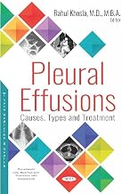 Pleural Effusions: Causes, Types and Treatment