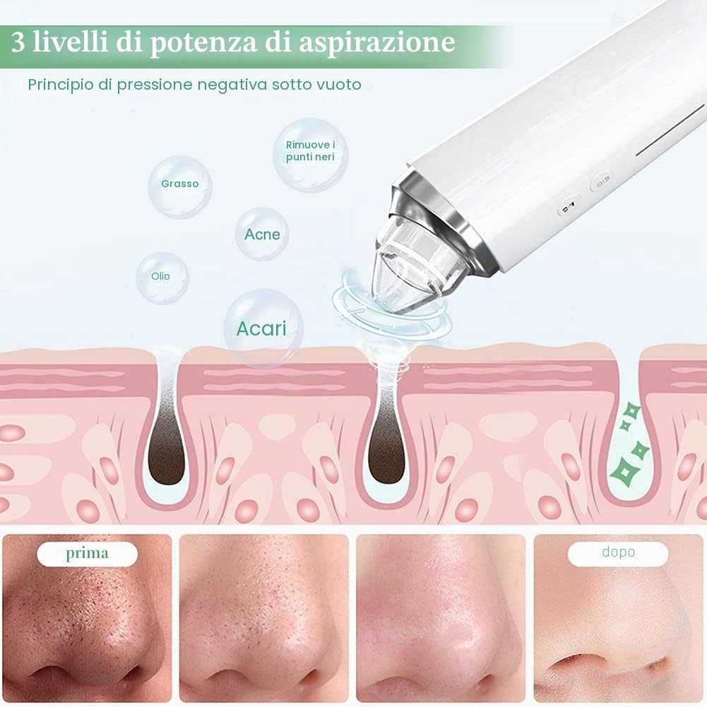 Aspiratore Punti Neri con Telecamera WiFi,Prabensei Professionale 6-In-1 1080P Telecamera Aspira Punti Neri Estrattore Punti Neri Naso Pulizia Viso Schiaccia Brufoli Comedoni Pori Rimuovi