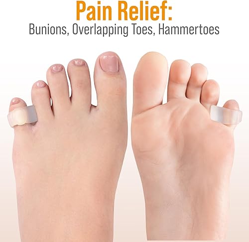 Miniatura 2 de 5 STARS UNITED Separadores de dedos de martillo enderezador de dedos  4 espaciadores de dedos pequeños  Esparcidor de gel  Corrector de dedos