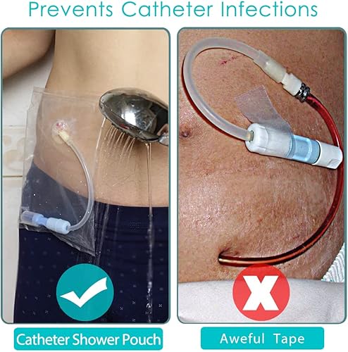 Miniatura 6 de 50 piezas impermeable protector de ducha para tubo de alimentación, soporte para catéter PD para diálisis peritoneal, bolsa de diálisis peritoneal,