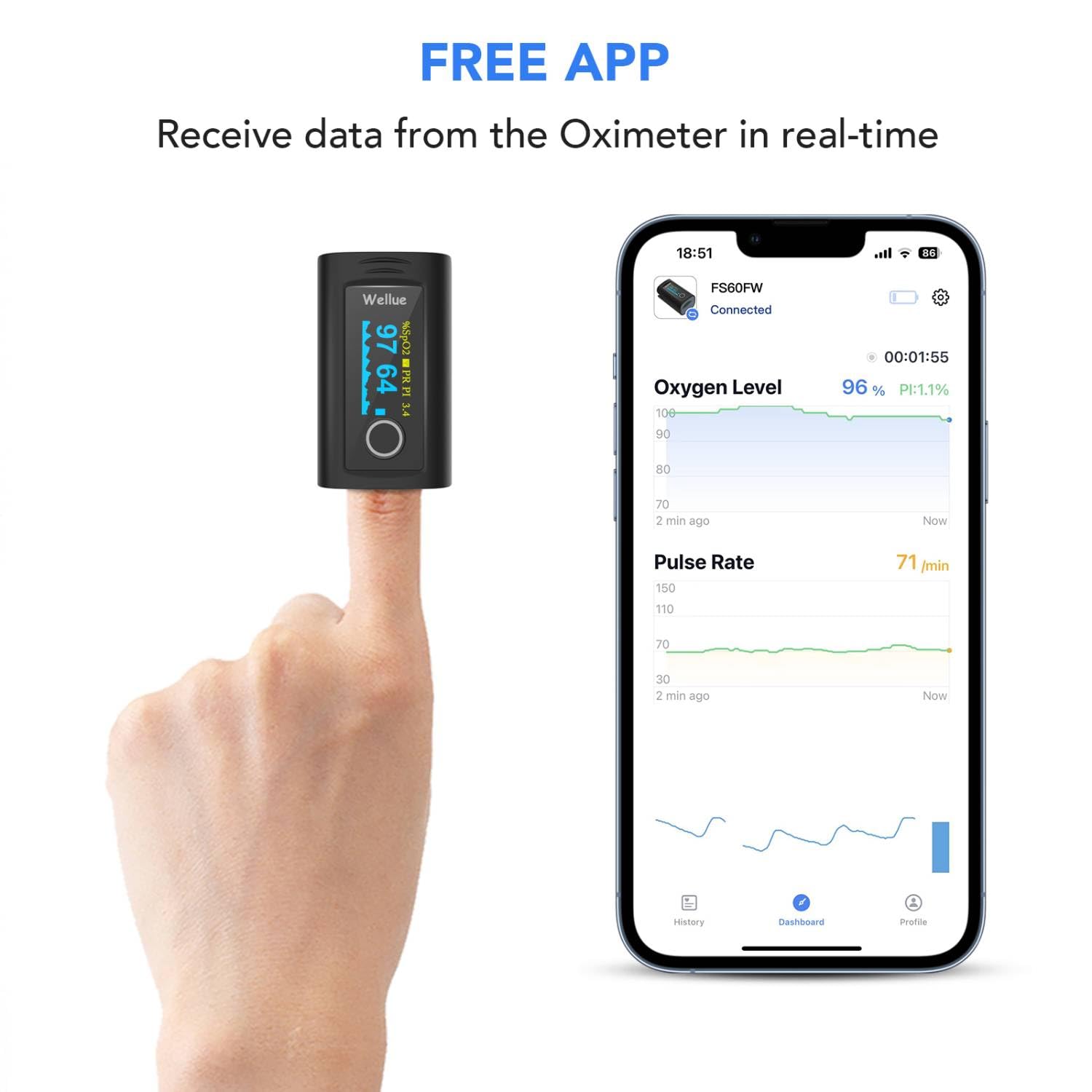 ViATOM Bluetooth Pulsoximeter Fingeroximeter mit APP und 12 Datensätze, Sauerstoffsättigung Messgerät Finger, Blutsauerstoffmessgerät Finger für Herzfrequenz mit Alarm, Professionell APP