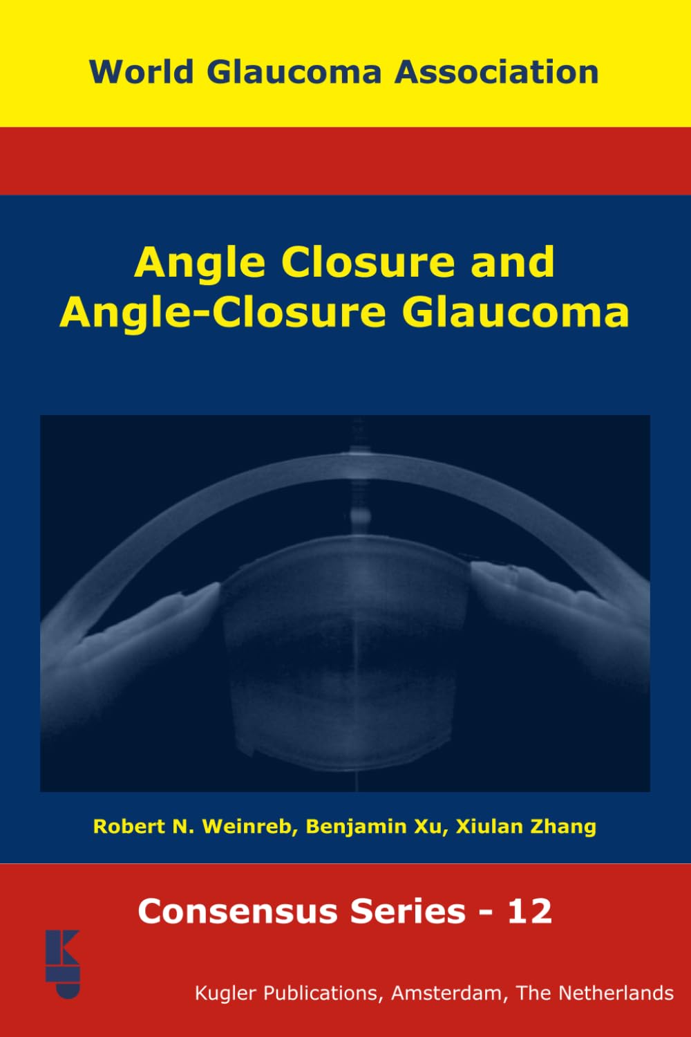 Angle Closure and Angle-Closure Glaucoma: 12