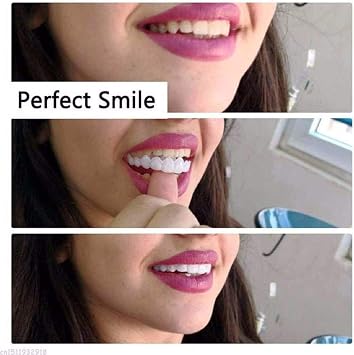2 Pairs Clip-on Veneers Teeth, Instantly Covers Irregular & Missing Teeth, Top & Bottom, 4 Items, 1 Count