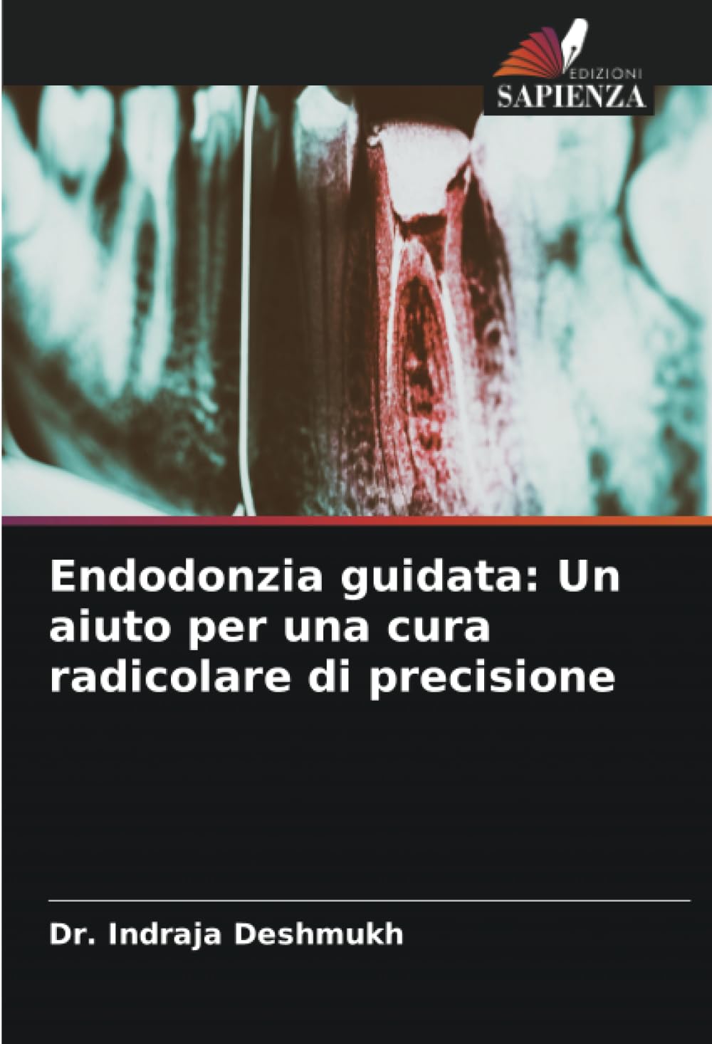 Endodonzia guidata: Un aiuto per una cura radicolare di precisione