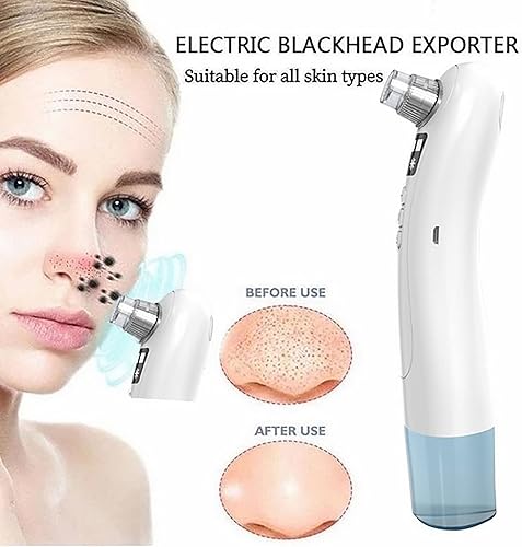 Miniatura 3 de Removedor de puntos negros, aspiradora de poros, espátula para la piel, herramienta extractora eléctrica de espinillas de comedones para acné,