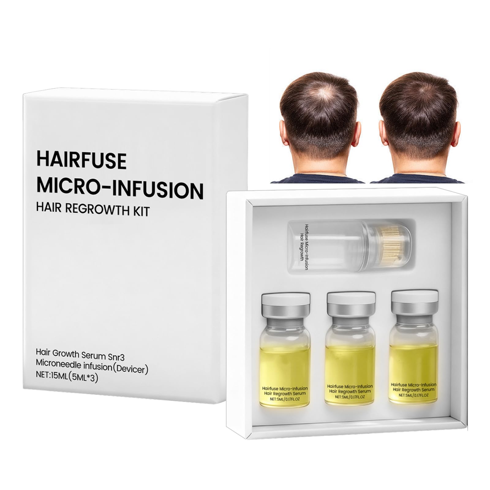 Micro Infusion Cheveux Colagea Micro Infuse Cheveux Homme Repousse Cheveu-x Favorise Pousse Chev-eux Rend Cheveu-x Plus Épais Fortifie Racines（5ml*3）