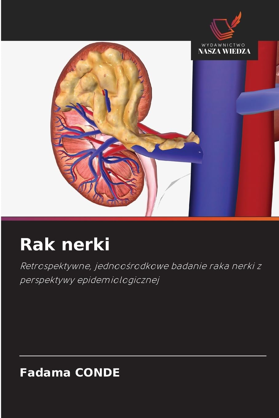 Rak nerki: Retrospektywne, jednoo¿rodkowe badanie raka nerki z perspektywy epidemiologicznej
