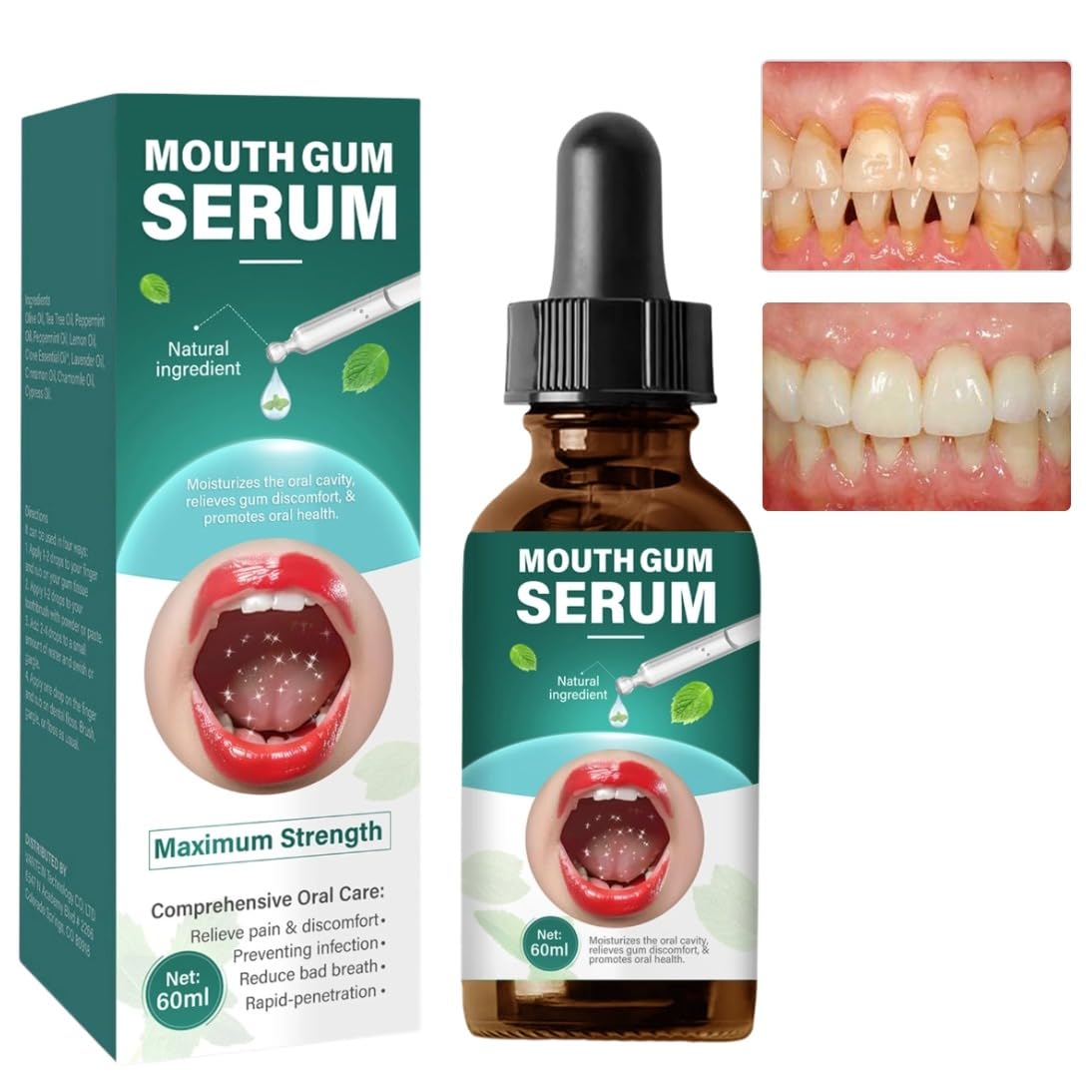 Gum Restore Drops, Natural Oral Care Serum for Gum &amp; Bad Breath Freshening