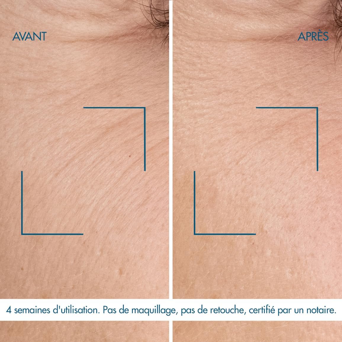 Biotherm, Blue Retinol Serum Nuit Visage, Pour Peau Normale à Grasse, Réduit les Rides et Unifie la Peau, Enrichi en Biotech Plankton et Rétinol, 30 ml