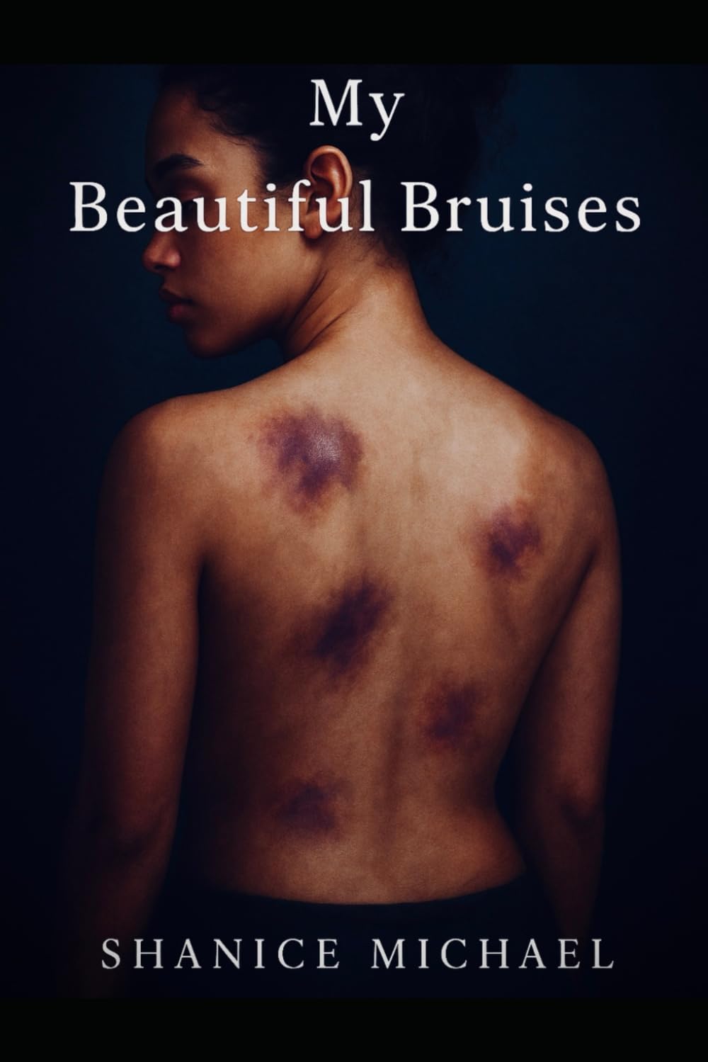 My Beautiful Bruises