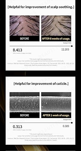 Miniatura 5 de Premium Hair Tonic Synergy Double Up - Suero para el cuero cabelludo engrosante del cabello para evitar la pérdida de cabello, fortalecimiento de