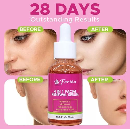 4 In 1 Facial Renewal Serum, With Vitamin C And E, Hyaluronic Acid And Niacinamide. Ultra Regenerating Facial Serum Treatment #TOP3