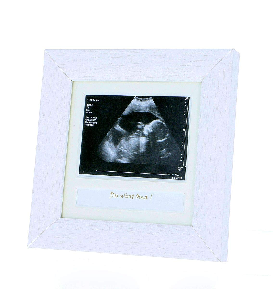 FmtwPhn Ultraschall Bilderrahmen - Baby Sonogramm Rahmen Für Werdende Mütter