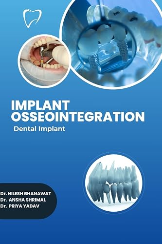 Implant Osseointegration Dental Implant