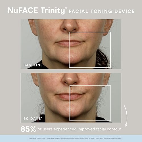 Miniatura 3 de NuFACE Trinity Facial Toning Device