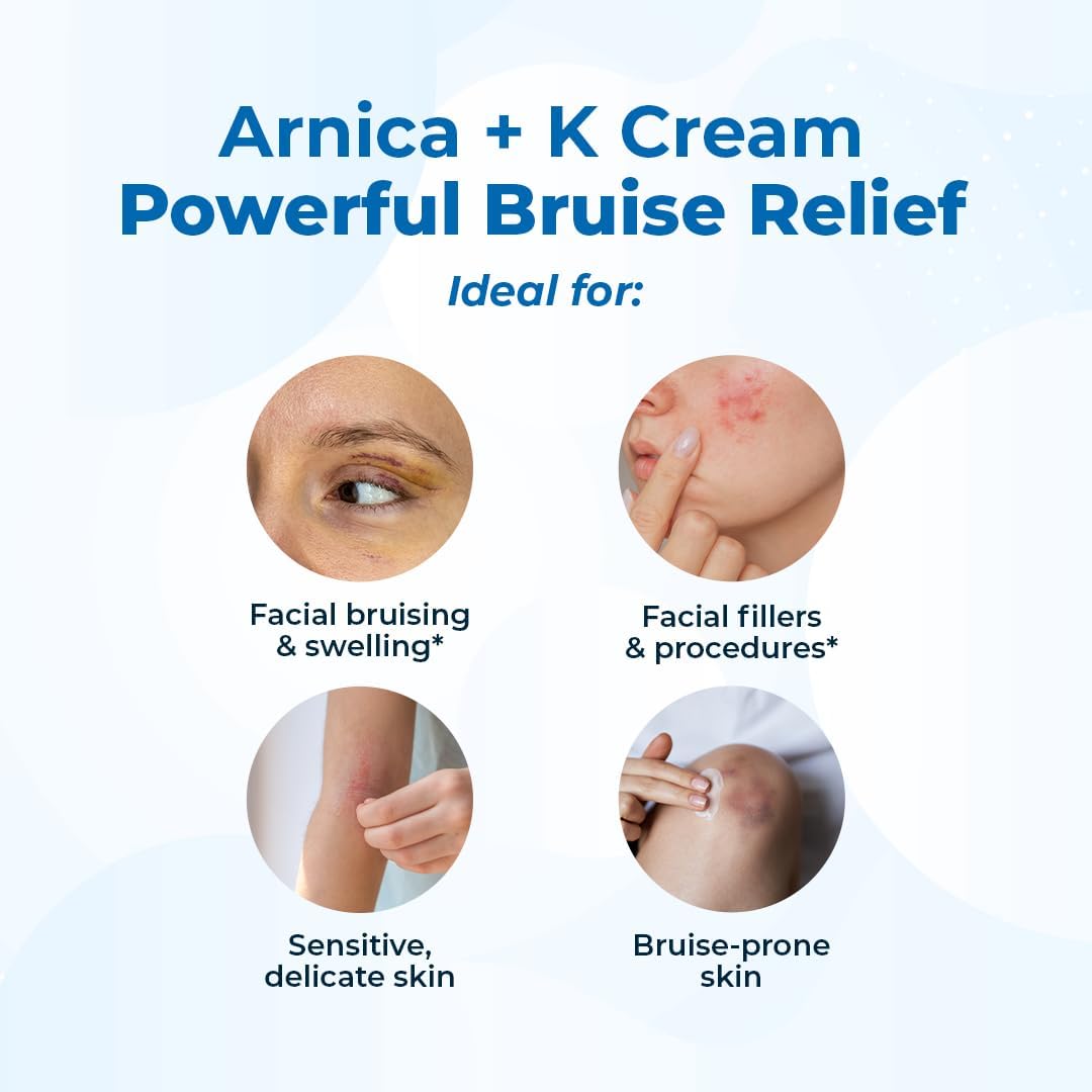 VitaMedica Arnica + Vitamin K Oxide Cream for Delicate Facial Skin, 0.5 oz