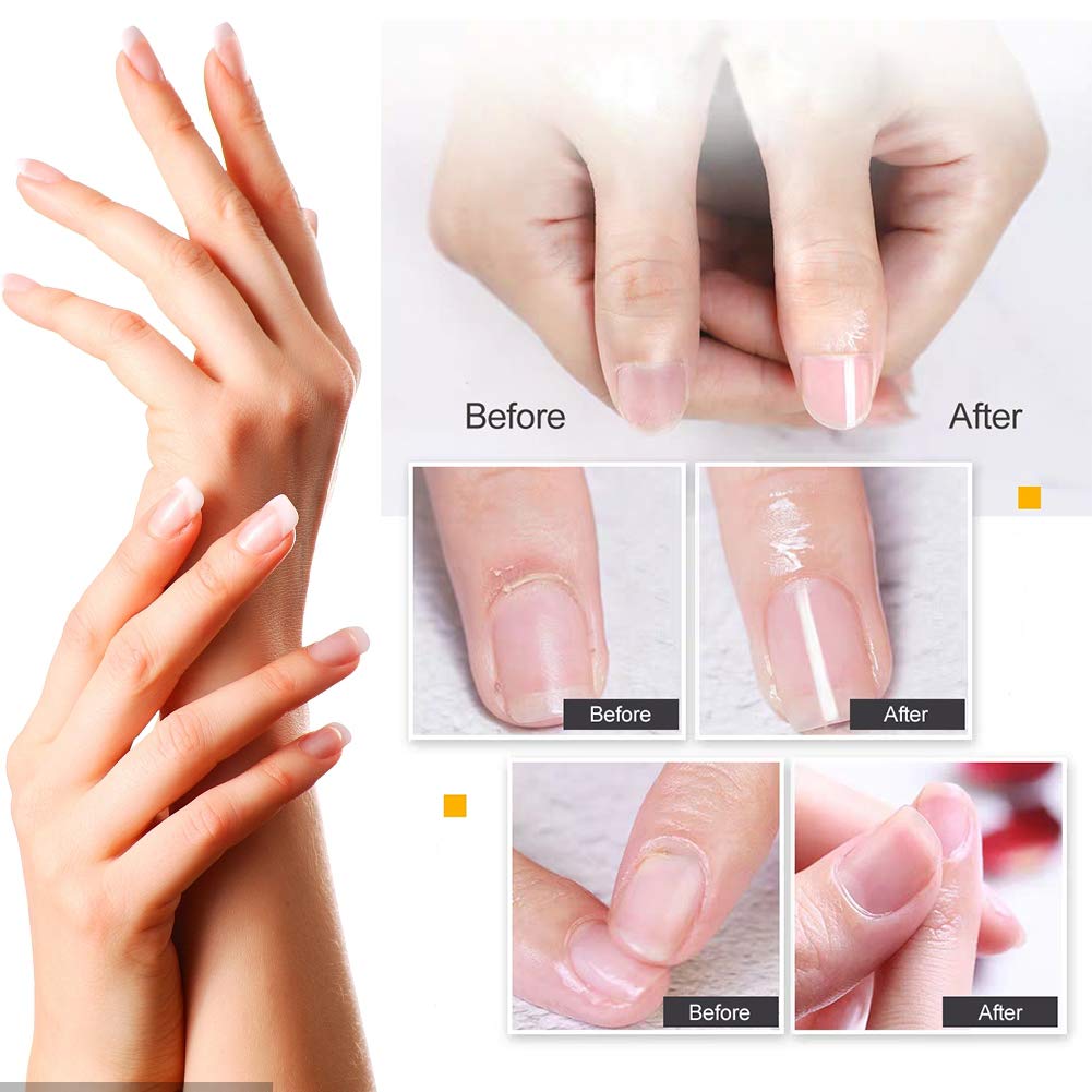 Trattamento Cuticole, Olio per cuticole, Siero trattamento unghie, Olio per cuticole penna Trattamento Olio per Cuticole Riparare la Cuticola Incrinata e Secca, 4 Pezzi