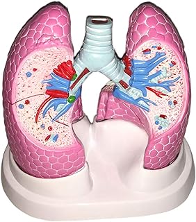Lung Model Human Bronchopulmonary Pathology Model Human Organ Model Healthy Lung and Diseased Lung Demonstration Visceral Organ Anatomical Medical Model