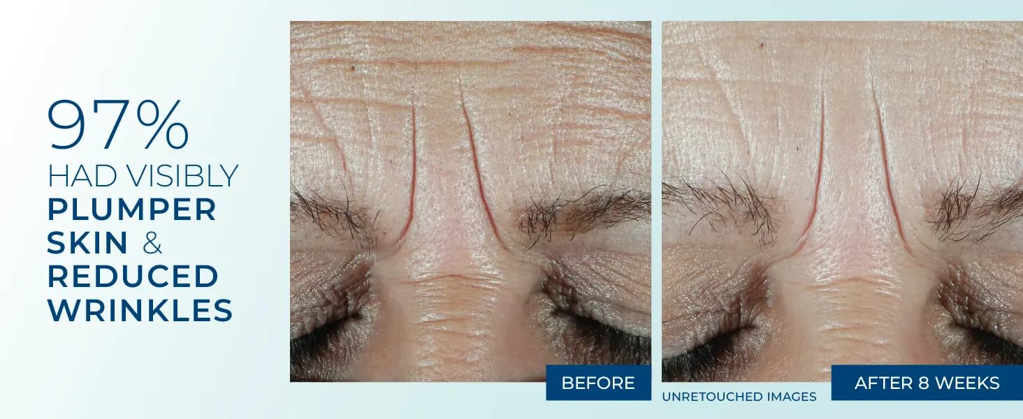 RoC Multi Correxion Hydrate & Plump Moisturizer Plus Hyaluronic Acid and SPF 30, 2.5 FL OZ, 2 Pack