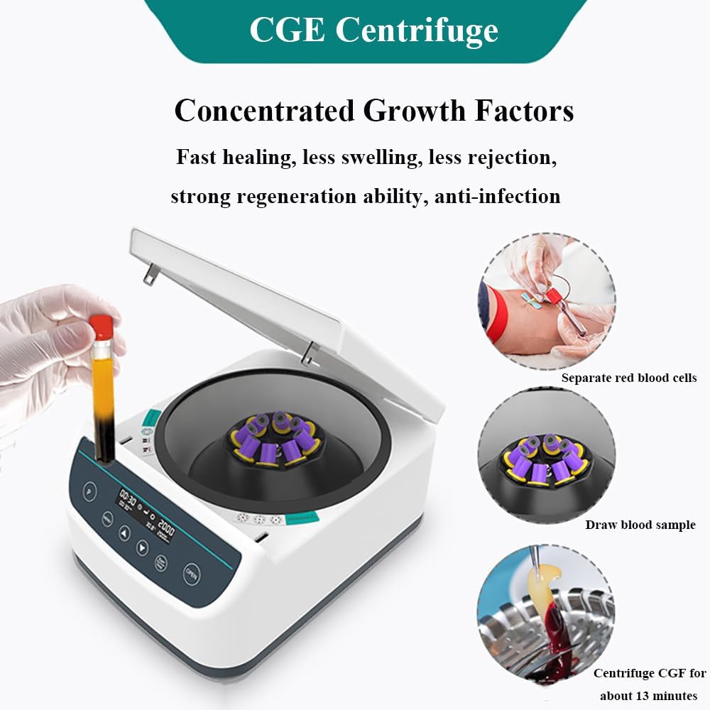 Lab Benchtop Centrifuge Machine,CGF Centrifuges,500-4000rpm,15ml*8/12 Capacity,4 Built-In Programs,Timer 30s-60min,Max. 1967xg/2075xg,For Plastic Surgery,Cosmetology,CGF-8