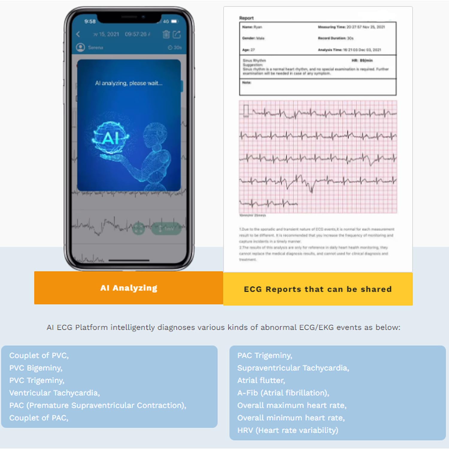 CheckMe Armfit Plus Tensiometro de brazo con ECG y análisis de informes de ECG, medición automática en 30S, APP Gratuita para Android e iOS, con gestión multiusuario y almacenamiento ilimitado