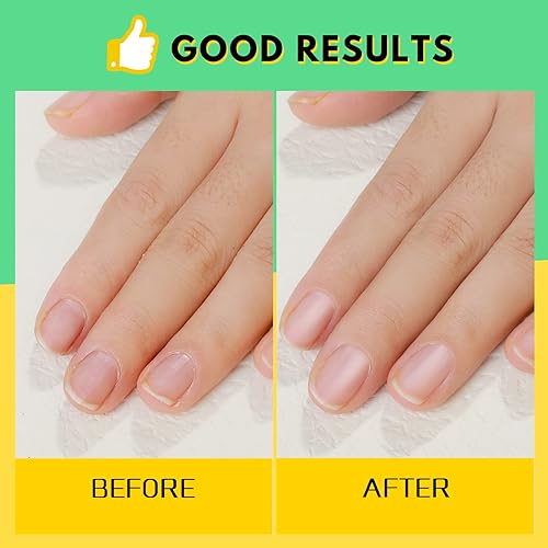 Miniatura 34 de FANDAMEI Limas de uñas y amortiguadores, herramientas de manicura kit de cuidado de uñas con lima de uñas, bloque de pulidor de uñas, cuidado