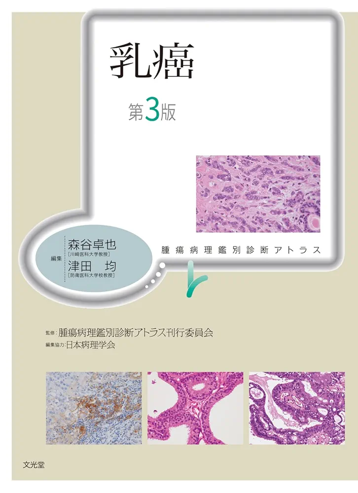 乳癌 (腫瘍病理鑑別診断アトラス) 津田 均; 森谷卓也 乳癌 (腫瘍病理鑑別診断アトラス) | 津田 均, 森谷卓也 |本