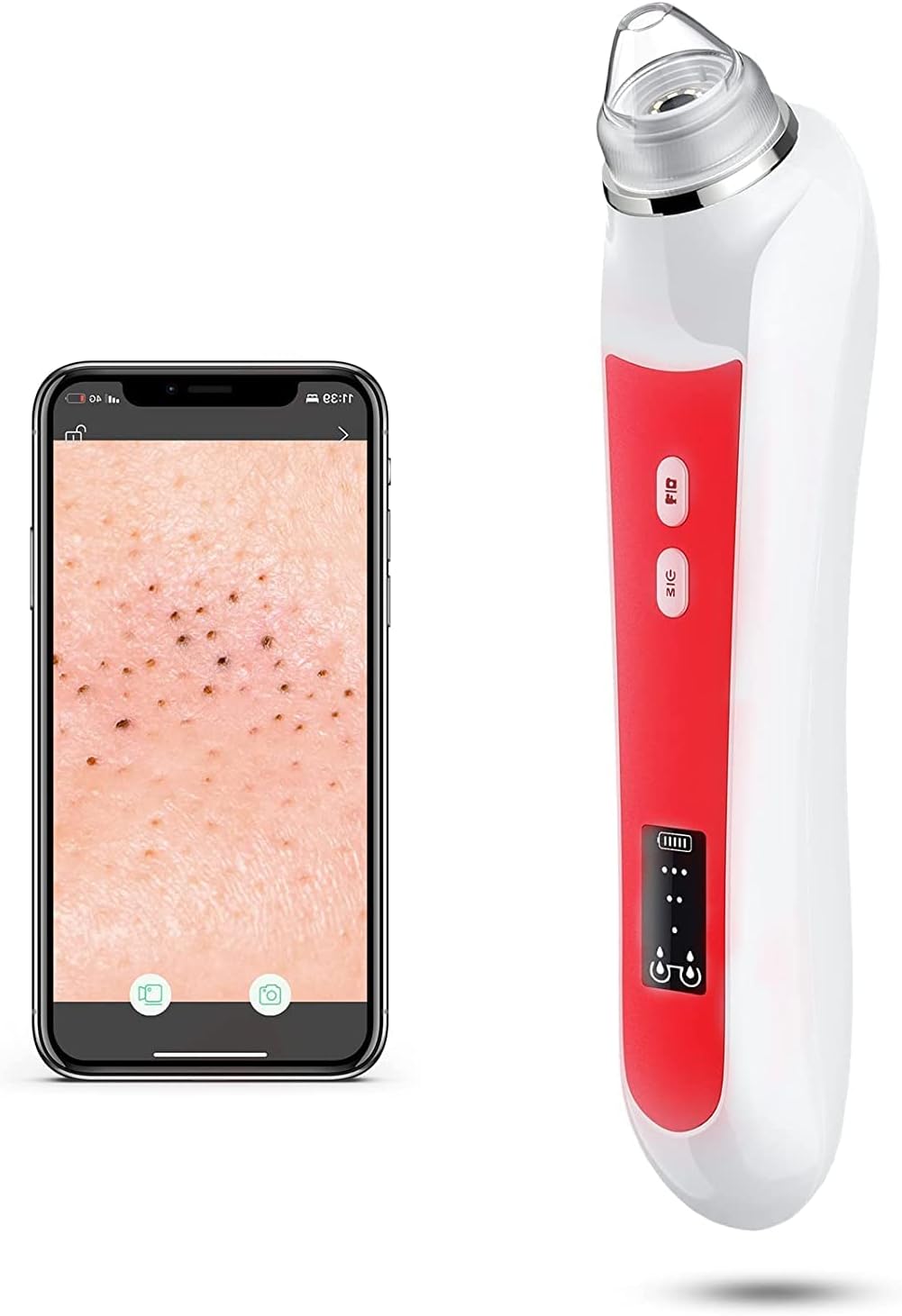 OttlebaBlackhead Remover Vacuum, Black Head Extractions Tool with Camerafor, USB Interface Type Pore Vacuum, Men and Women Pore Cleaner, 6 Suction Heads & 3 Adjustment Modes (Red)