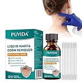 antiverrugas isdin cuanto tarda Diseño Portátil: Ideal para llevar en el día a día o viajes. Compacto y listo para usar en cualquier momento