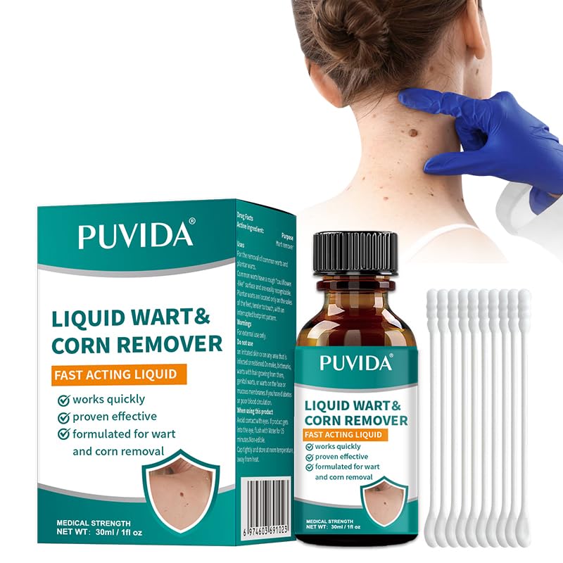 Kit Eliminar Verrugas 30ml - Elimina Suavemente Verrugas de Manos y Cuerpo