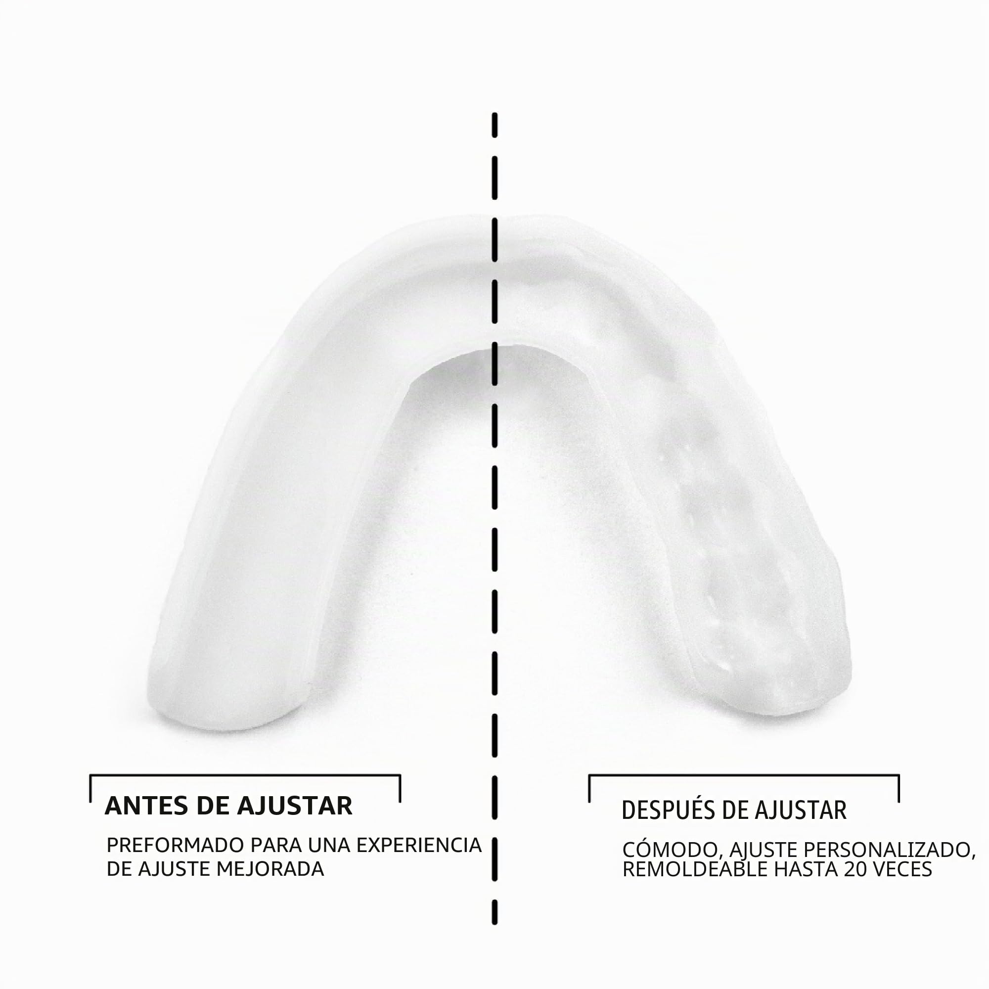 SOVA 3D Night Guard - 1,6 mm de Grosor - Ajuste Personalizado - Protector Bucal Contra el Rechinar y Apretar de Dientes Nocturno - Férula de Descarga Sin Olor ni Sabor - No Tóxica.