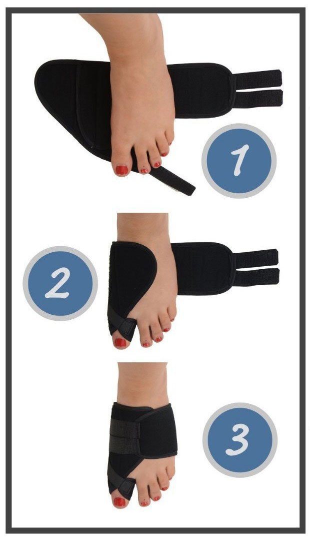 PEDIMEND zszyty korektor dwutlenkowy (1 para – 2 szt.) - Hallux Valgus szyna dwuosobowa z dużymi palcami - leczenie bólu w paluksie koślawego na dobranie - koryguje wyrównanie dużych palców - unisex - pielęgnacja stóp (S: Wielka Brytania 2,5-4)