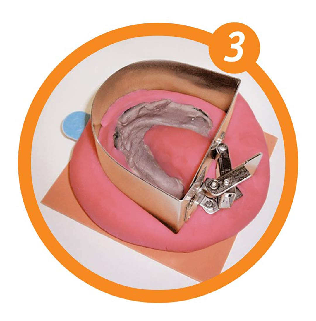 Dental Creations Wonderformer Box and Pour Model Casting Former – Box and Bead Model Former – Stainless Steel – Includes Quick Release Clip and Divider Insert