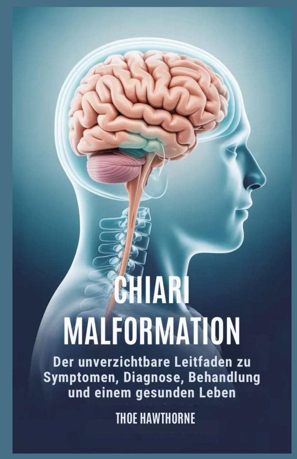 Chiari Malformation: Der unverzichtbare Leitfaden zu Symptomen, Diagnose, Behandlung und einem gesunden Leben