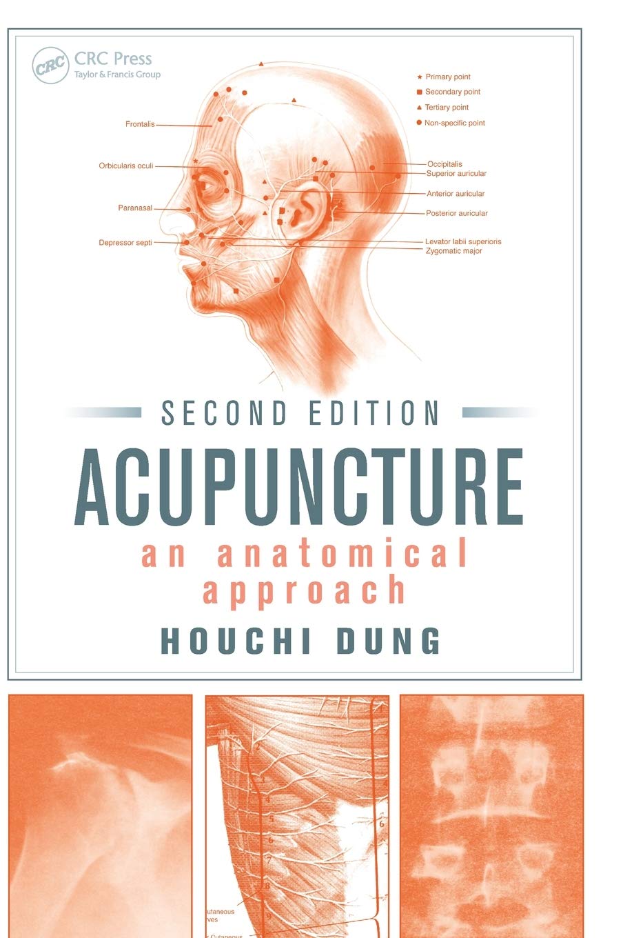 Acupuncture: An Anatomical Approach, Second Edition: 9781466581920 ...