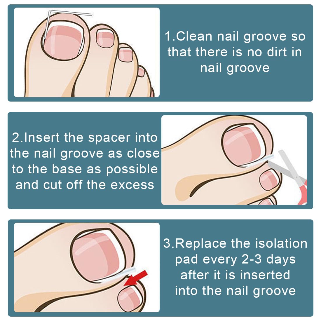 51 Piezas Juego de correctores para uñas encarnadas: tiras alisadoras de uñas sin dolor con elevador de uñas: kit de herramientas para uñas encarnadas de fácil uso