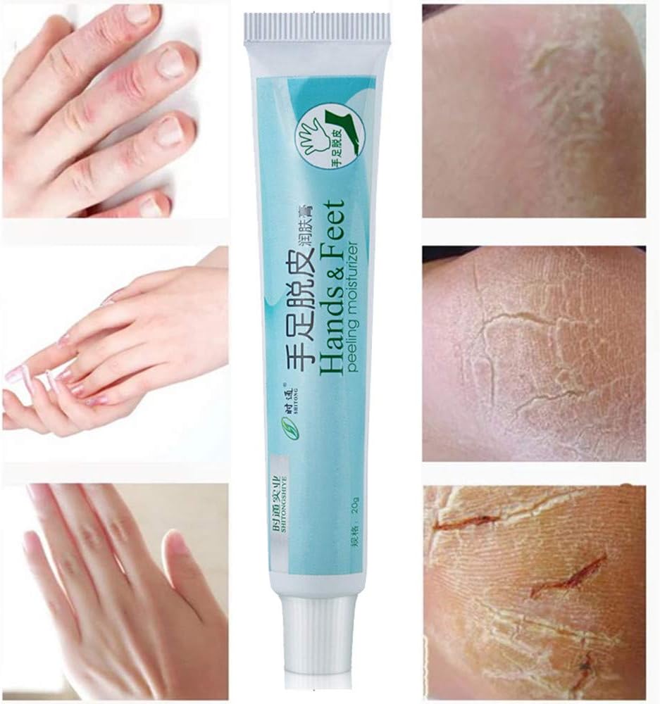 Iusun Heel Balm, Cracked Heel Balm Cream for Rough Dry & Cracked Chapped Feet Heel Skin Care