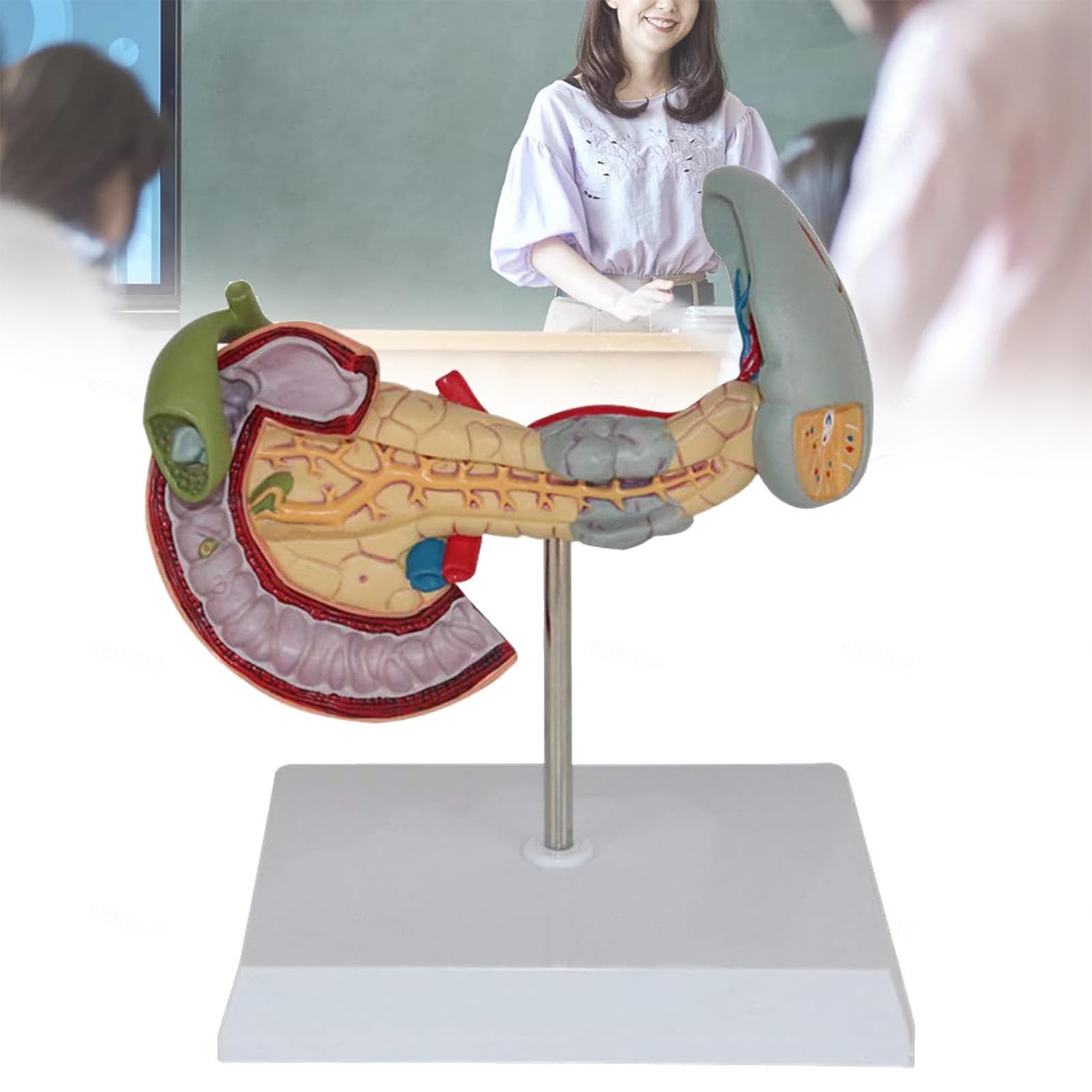 Anatomical model of the pancreas, spleen, and duodenum with pathology - digestive for medical training