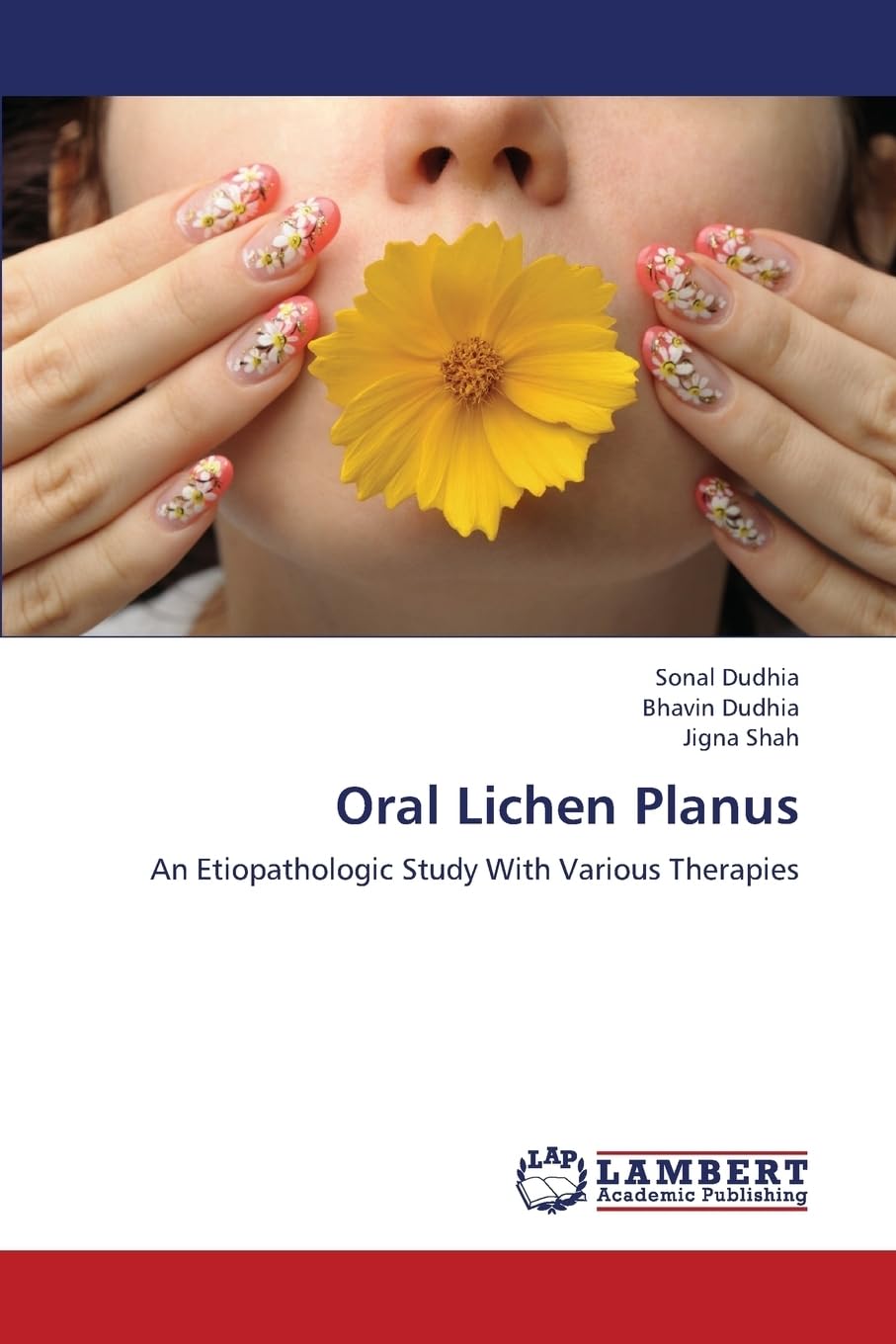 Oral Lichen Planus