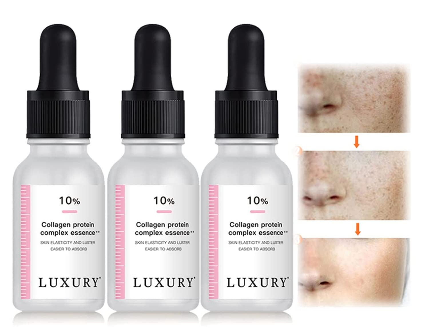 Sheep Placenta Collagen Serum, BlemishSkin Corrector Serum, Brightening Face Moisturizer, Collagen Protein Complex Essence Serum - Anti-Dark Spots & Brightening Serum (3pcs)