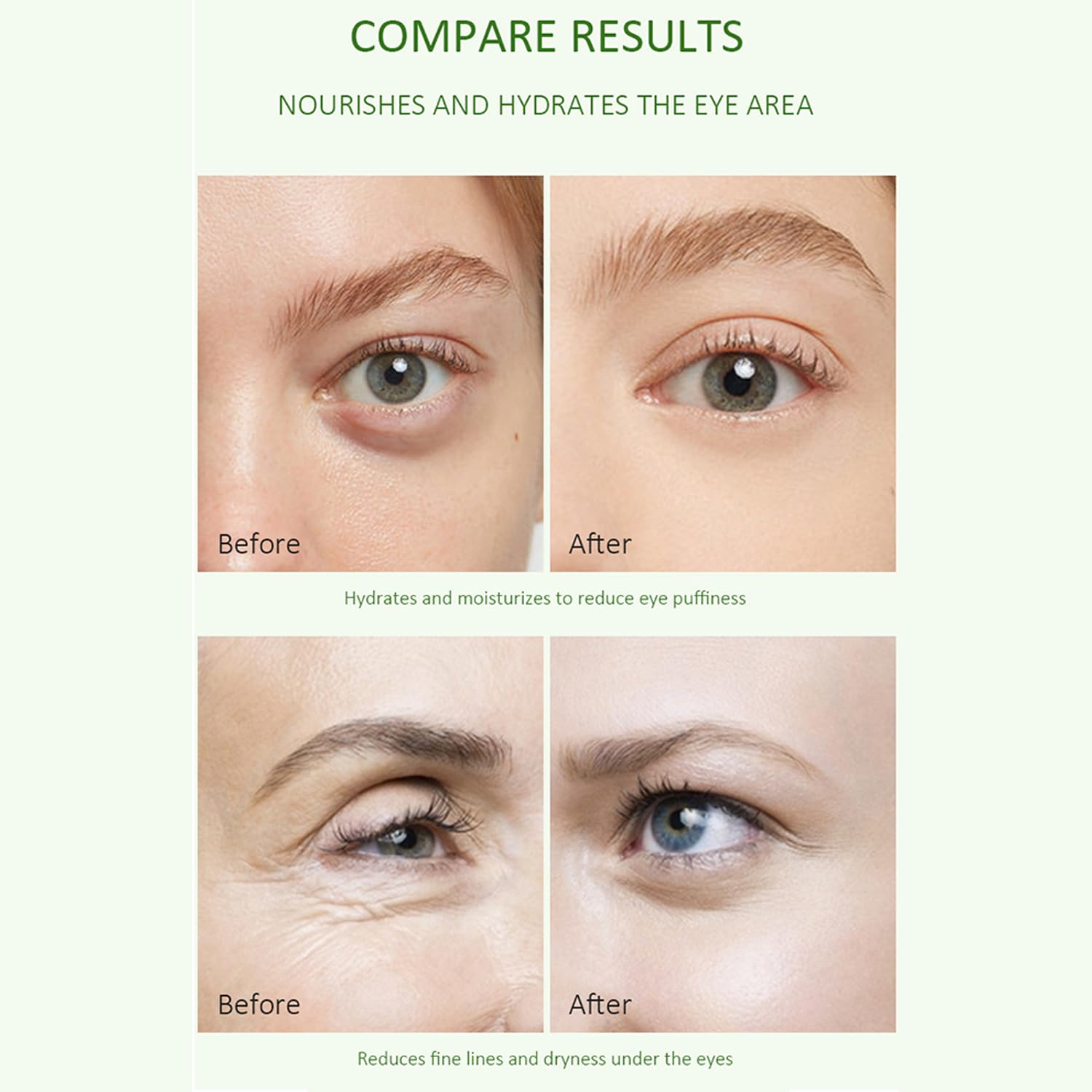 Amazon.com: Aloe Vera Eye Serum for Dark Circles,Deeply Moisturizing,Anti  Aging, Smooth Fine Lines and Crows Feet,Tightening and Lifts Eye  Skin,Enhance Skin Elasticity,Fragrance Free(1 OZ) : Beauty & Personal Care
