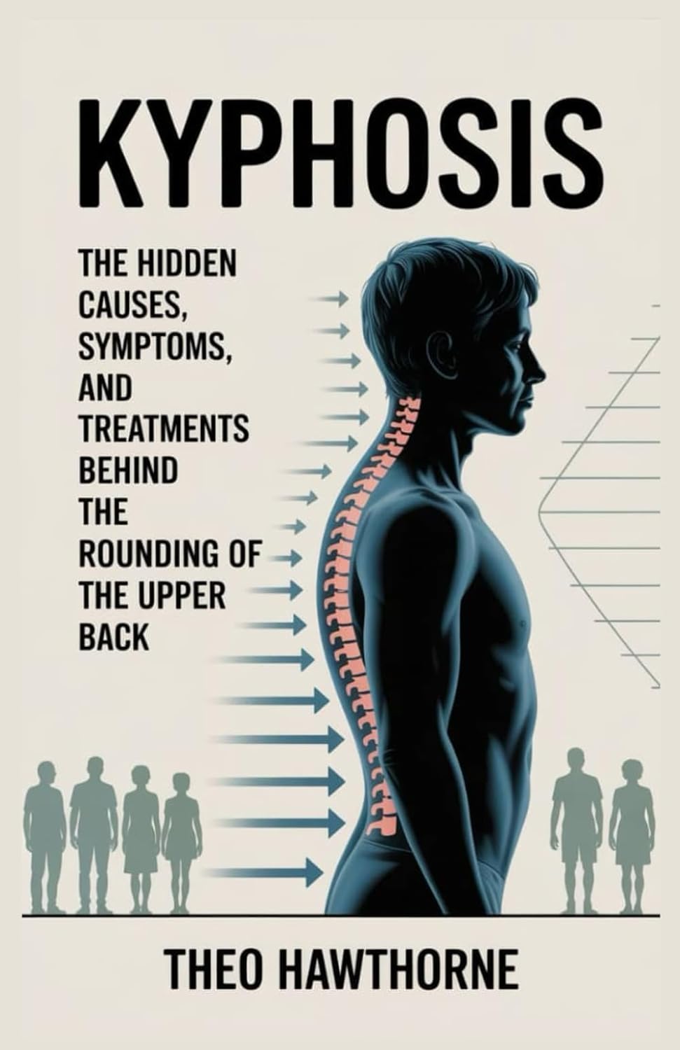 Kyphosis: The Hidden Causes, Symptoms, and Treatments Behind the Rounding of the Upper Back      Paperback – January 6, 2026