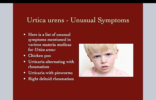 Miniatura 7 de Urtica Urens Crema 1 Pack