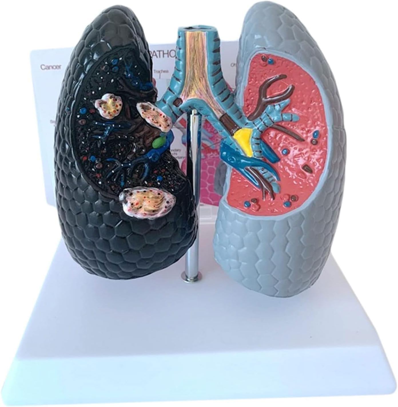 Model porównawczy palenia i zdrowych płuc, model anatomiczny dróg oddechowych i oskrzeli do nauczania, narzędzie do wyświetlania nauczania medycznego