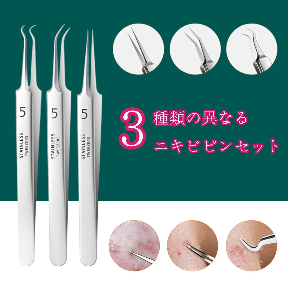 Amazon | 角栓ピンセット専用セット - 精密ピンセットで粉刺と黒ずみ