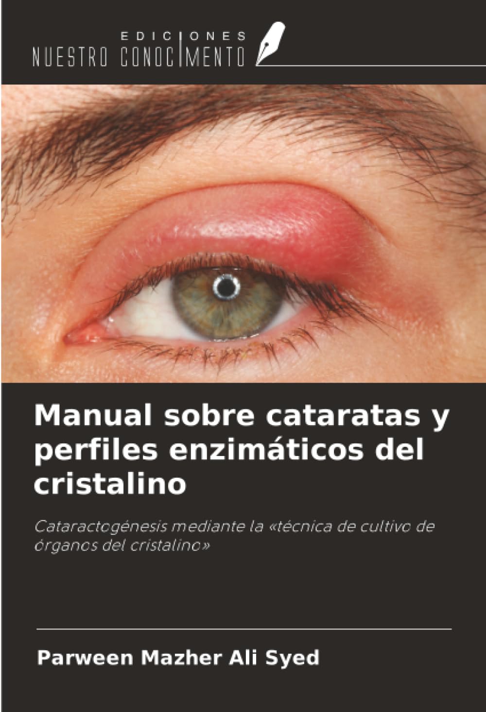Manual sobre cataratas y perfiles enzimáticos del cristalino: Cataractogénesis mediante la «técnica de cultivo de órganos del cristalino»