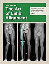 The Art of Limb Alignment, Twelfth Edition