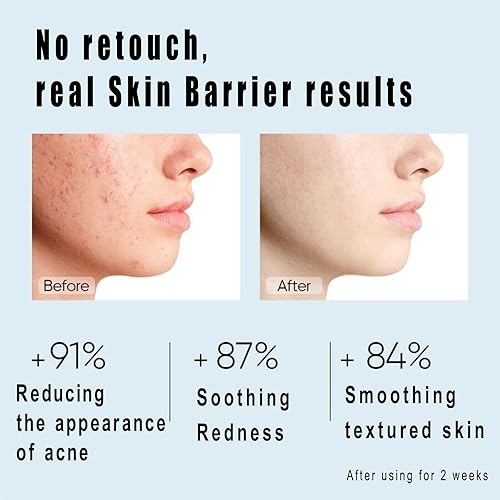 Miniatura 3 de Crema reparadora de barrera, crema hidratante antienvejecimiento con ácido hialurónico y 5 ceramidas, 24 horas, hidratante, sin aceite, alivia el