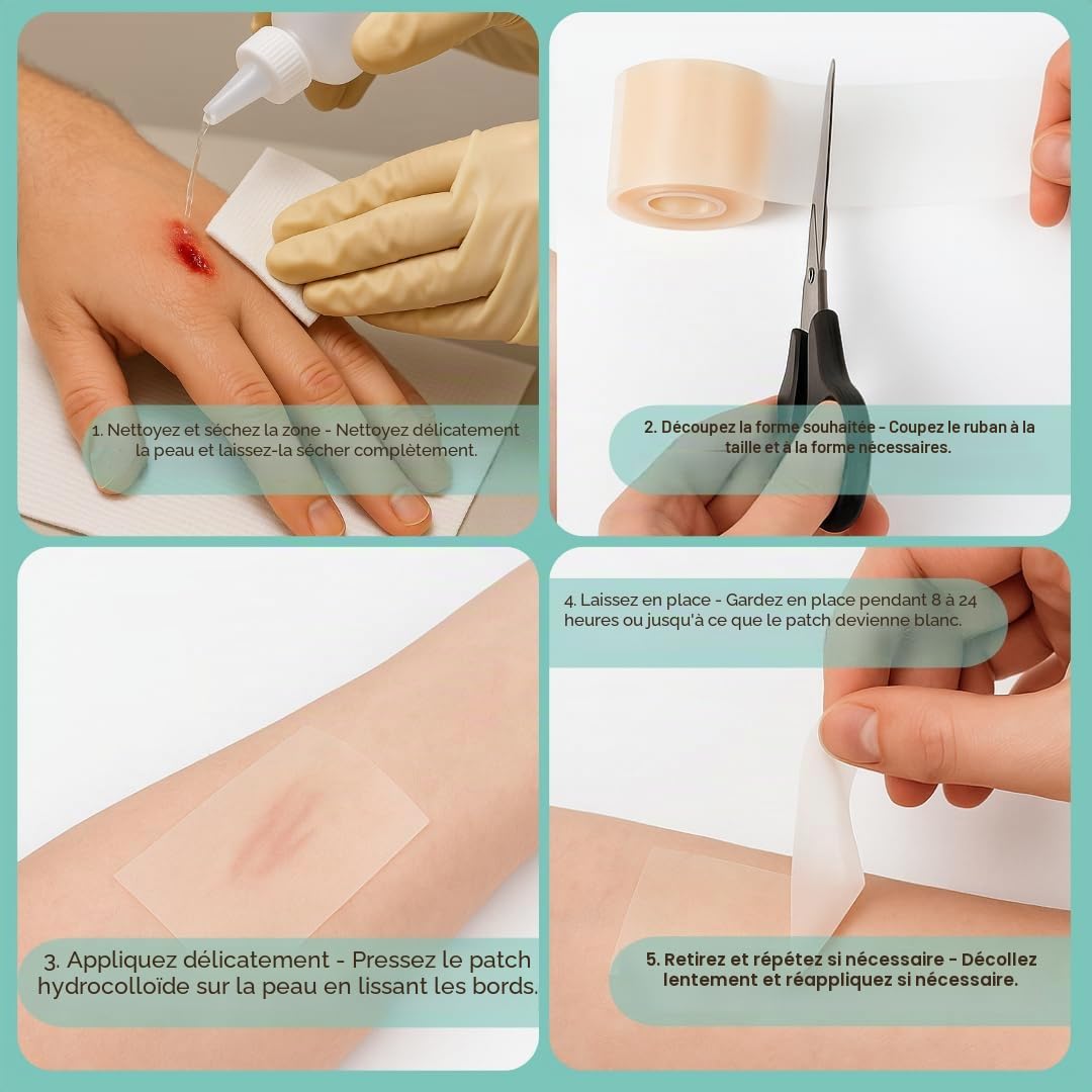 Rouleau de pansement hydrocolloïde 5 cm x 5 m – Ruban adhésif imperméable à découper – Patch de bandage flexible et doux pour la peau pour ampoules, acné, plaies mineures – Autocollant et sans latex