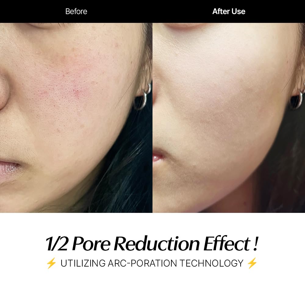 CELORABY Potension Penta-Shot Glass Skin Glow Booster | 5-in-1